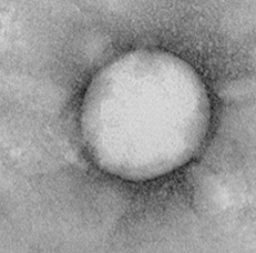 liposome nanoparticle image2